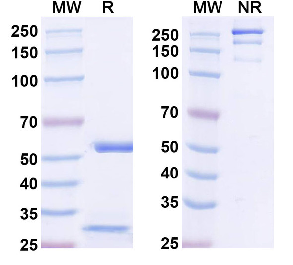 Anti-DNAH7 Recombinant Monoclonal Antibody (N250/21) - SDS-PAGE