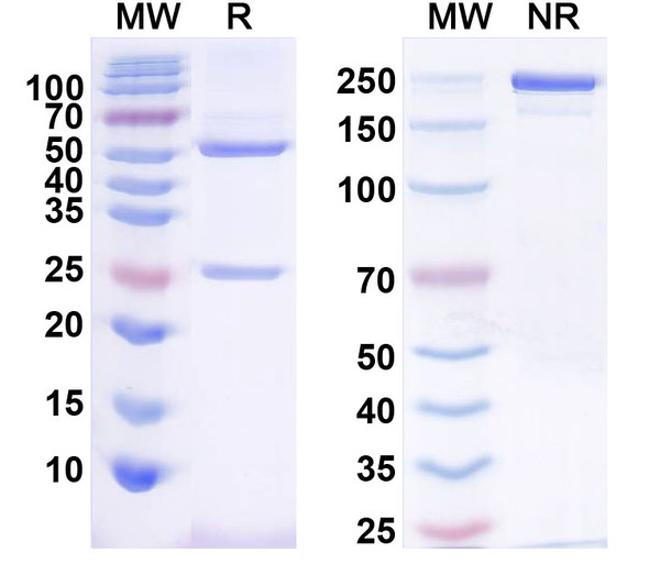 Anti-Fig4/Sac3 Recombinant Monoclonal Antibody (N202/38) - SDS-PAGE