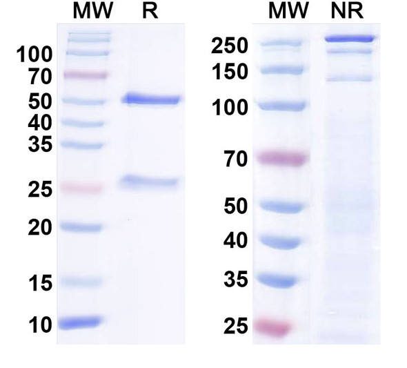 Anti-SAP102 Recombinant Monoclonal Antibody (N19/17) - SDS-PAGE
