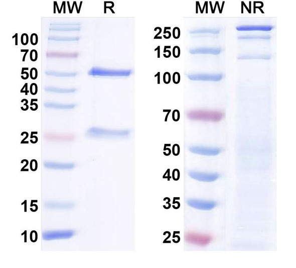 Anti-SAP102 Recombinant Monoclonal Antibody (N19/2) - SDS-PAGE