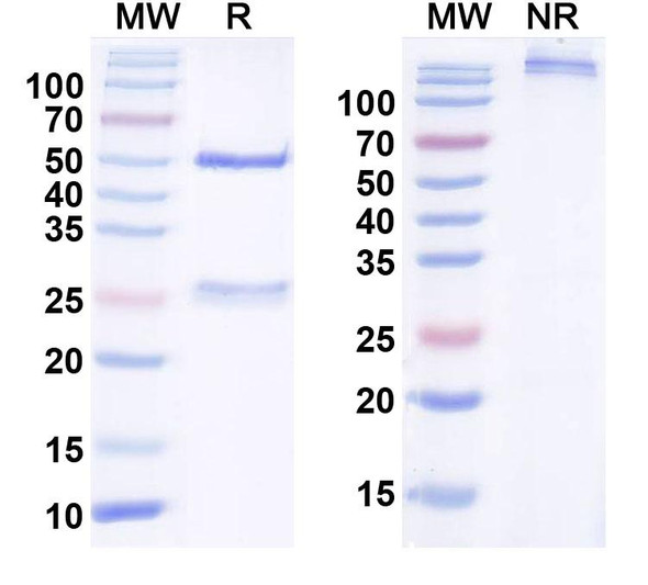 Anti-FGF13/FHF2 Recombinant Monoclonal Antibody (N225A/10) - SDS-PAGE