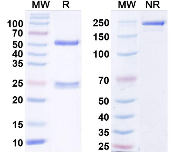 Anti-FGF14/FHF4 Recombinant Monoclonal Antibody (N56/21) - SDS-PAGE
