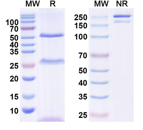Anti-QKI-6 Recombinant Monoclonal Antibody (N182/6) - SDS-PAGE