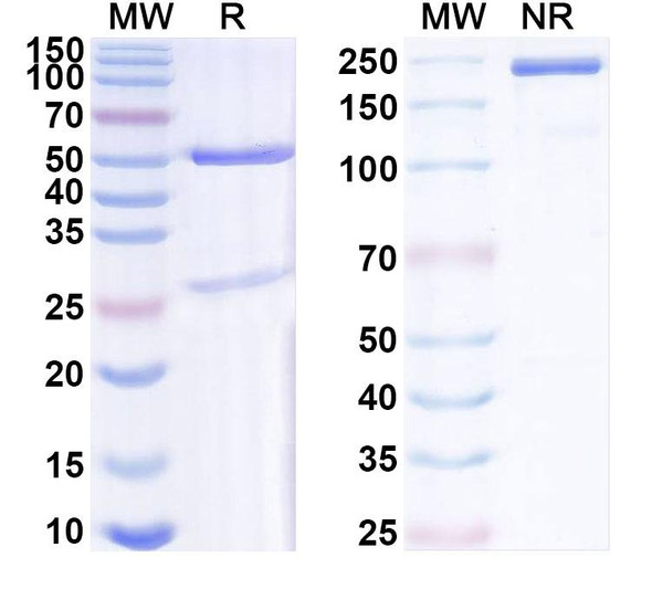 Anti-QKI-7 Recombinant Monoclonal Antibody (N183/15) - SDS-PAGE