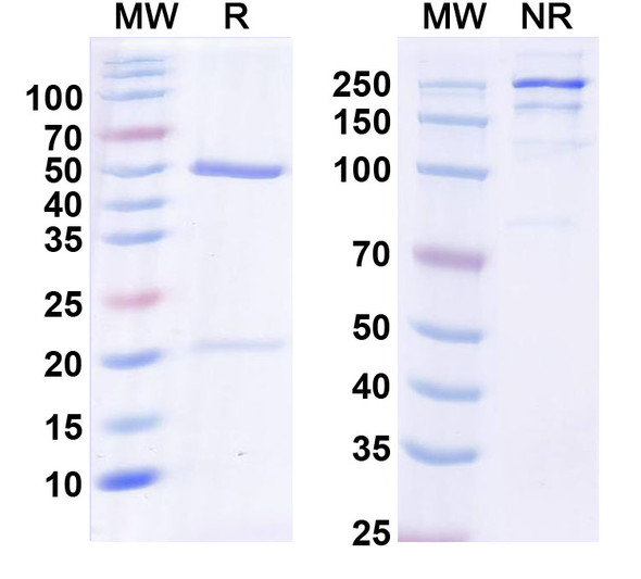 Anti-TrpM7 Recombinant Monoclonal Antibody (N74/25) - SDS-PAGE