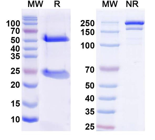 Anti-MPP8 Recombinant Monoclonal Antibody (N119/46) - SDS-PAGE