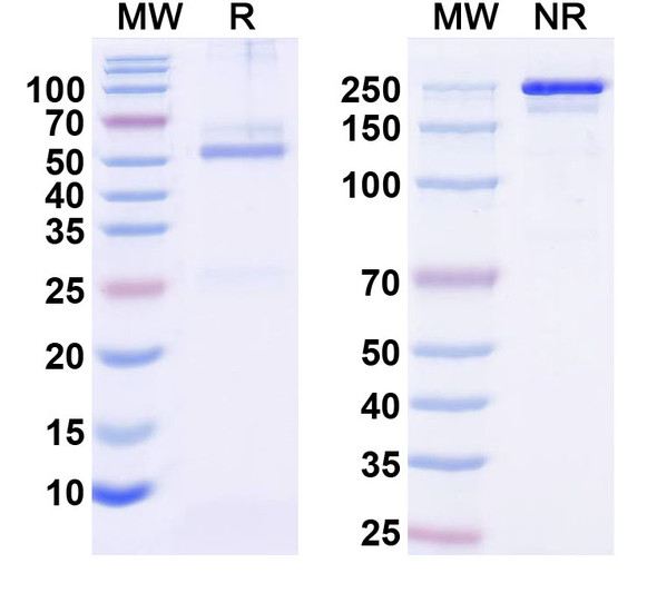 Anti-SynDIG4 Recombinant Monoclonal Antibody (L102/71) - SDS-PAGE