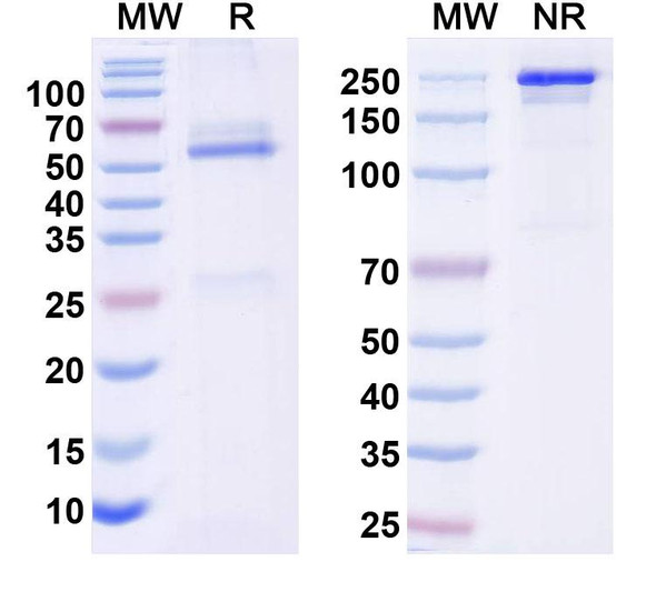 Anti-REEP2 Recombinant Monoclonal Antibody (N326B/47) - SDS-PAGE
