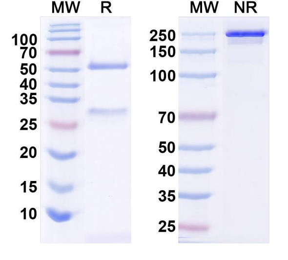 Anti-SALM4 Recombinant Monoclonal Antibody (N139/17) - SDS-PAGE