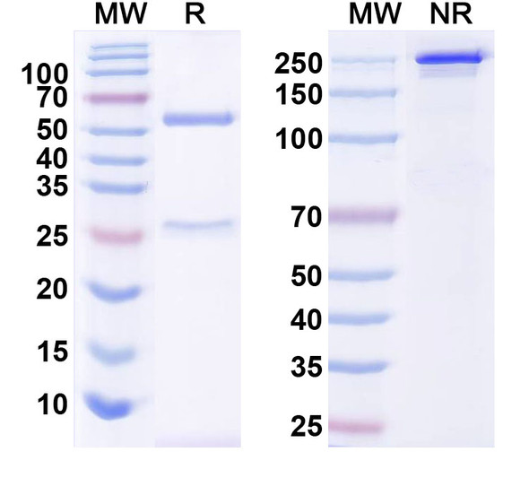 Anti-TrpM6 Recombinant Monoclonal Antibody (N470/22) - SDS-PAGE