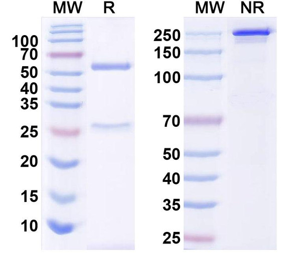 Anti-PINK1 Recombinant Monoclonal Antibody (N4/19) - SDS-PAGE
