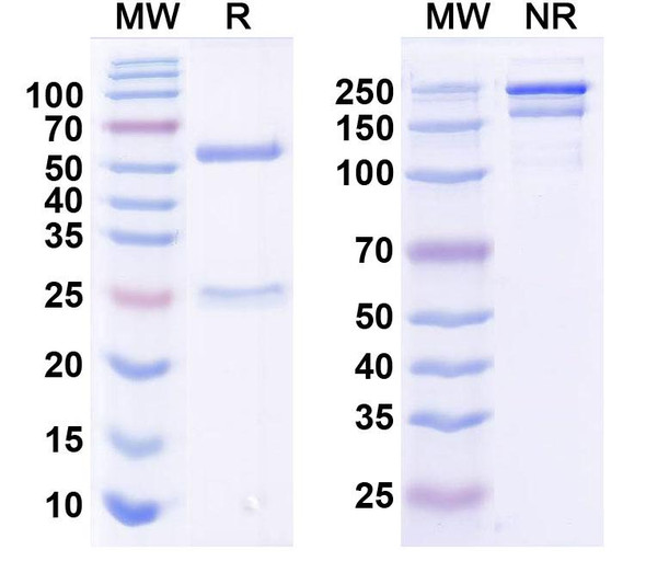 Anti-WNK3 Recombinant Monoclonal Antibody (N392/80) - SDS-PAGE