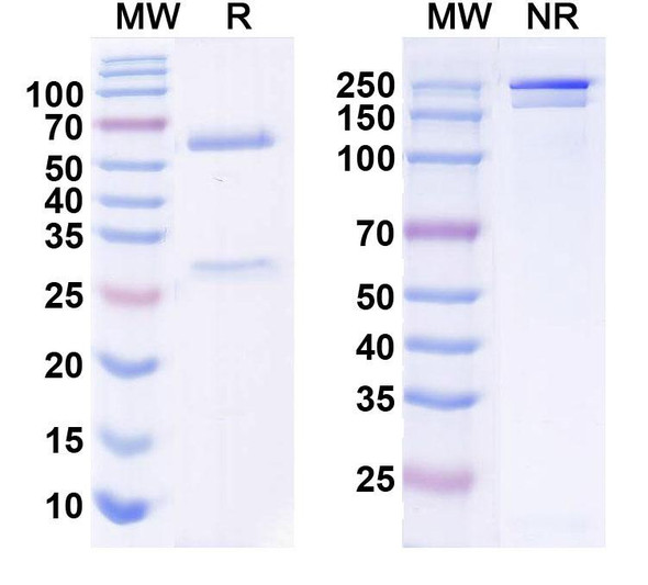 Anti-ANO3/TMEM16C Recombinant Monoclonal Antibody (N454/55) - SDS-PAGE