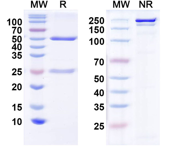 Anti-NSD3 Recombinant Monoclonal Antibody (N348/63) - SDS-PAGE