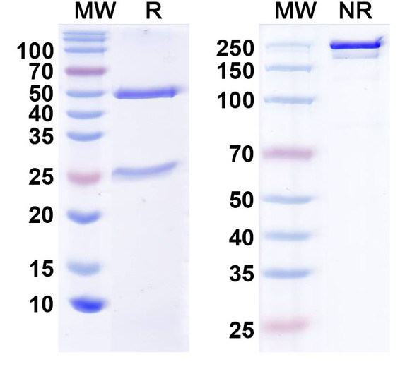 Anti-CELF4/BRUNOL4 Recombinant Monoclonal Antibody (N446/80) - SDS-PAGE