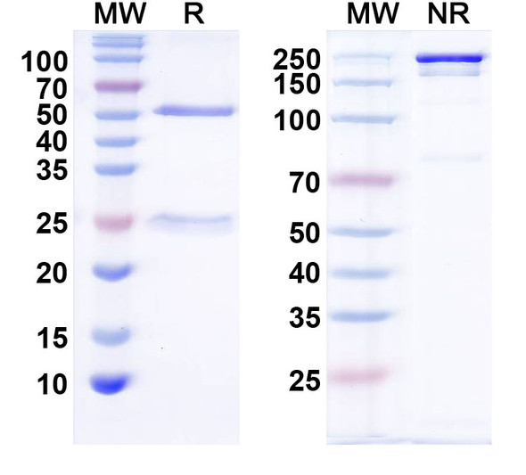 Anti-TRPML1 Recombinant Monoclonal Antibody (N267/52) - SDS-PAGE