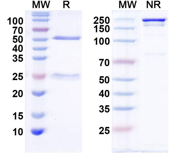 Anti-TRPML1 Recombinant Monoclonal Antibody (N267/52) - SDS-PAGE