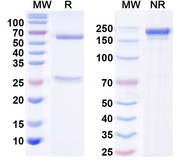 Anti-WNK1 Recombinant Monoclonal Antibody (N391/68) - SDS-PAGE
