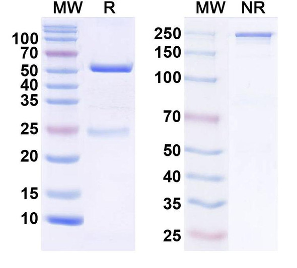 Anti-NGL-2/LRRC4 Recombinant Monoclonal Antibody (N50/36) - SDS-PAGE