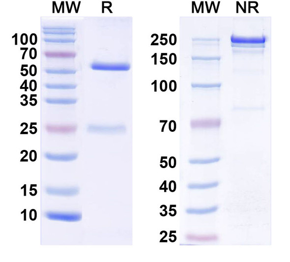 Anti-NGL-1/LRRC4C Recombinant Monoclonal Antibody (N49A/2) - SDS-PAGE