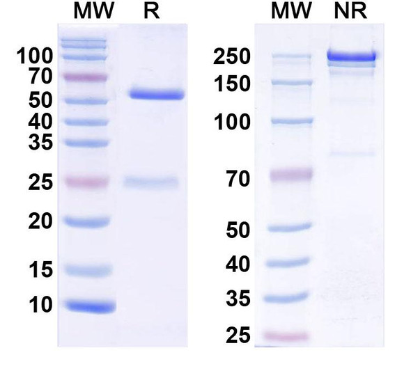 Anti-NGL-1/LRRC4C Recombinant Monoclonal Antibody (N49A/21) - SDS-PAGE