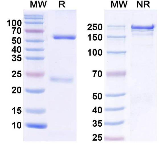 Anti-TrpC7 Recombinant Monoclonal Antibody (N64A/23) - SDS-PAGE