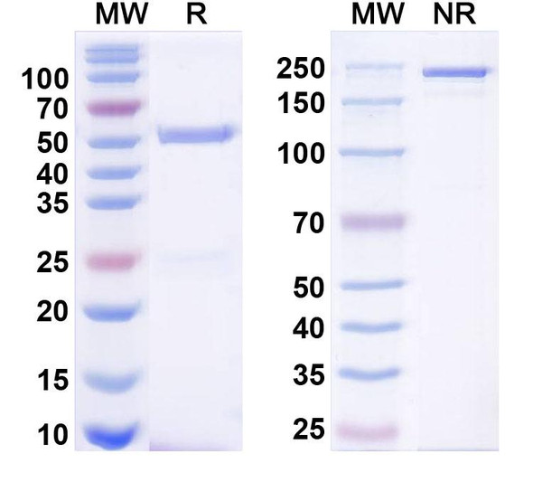 Anti-PICK1 Recombinant Monoclonal Antibody (L20/23) - SDS-PAGE