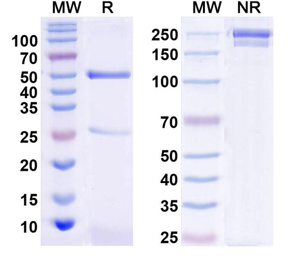 Anti-Kv11.3 K+ channel Recombinant Monoclonal Antibody (N447/24) - SDS-PAGE