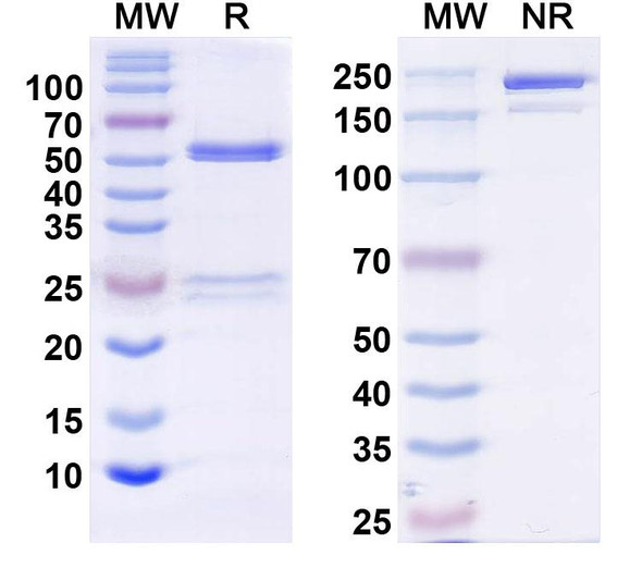 Anti-KChIP2b K+ channel Recombinant Monoclonal Antibody (K60/87) - SDS-PAGE