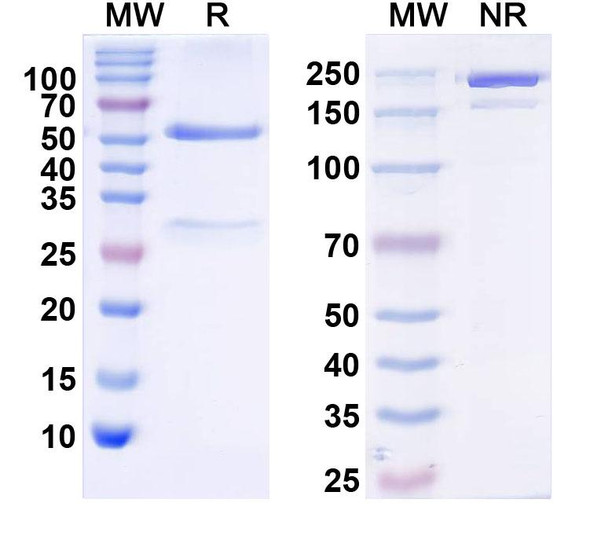 Anti-Kv4.1 K+ channel Recombinant Monoclonal Antibody (K93X/22) - SDS-PAGE