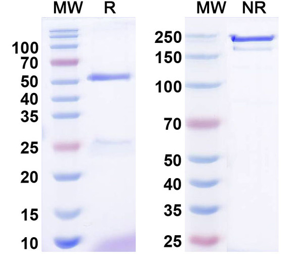 Anti-ANO10/TMEM16K Recombinant Monoclonal Antibody (N475A/17) - SDS-PAGE