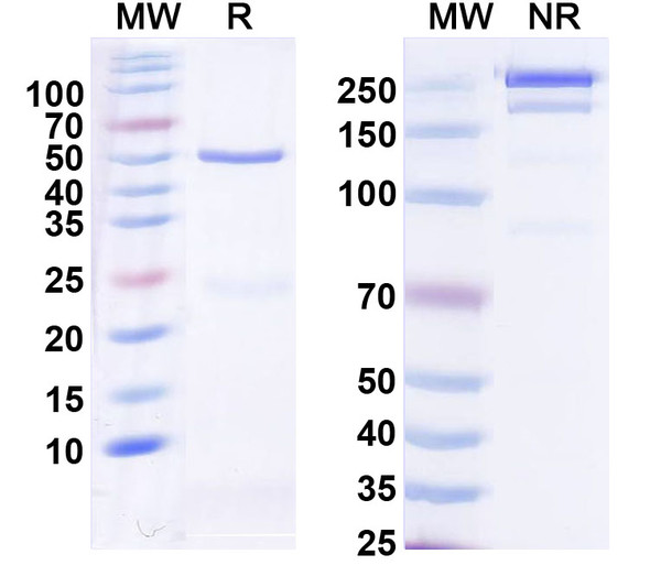 Anti-CLN6 Recombinant Monoclonal Antibody (N400/36) - SDS-PAGE