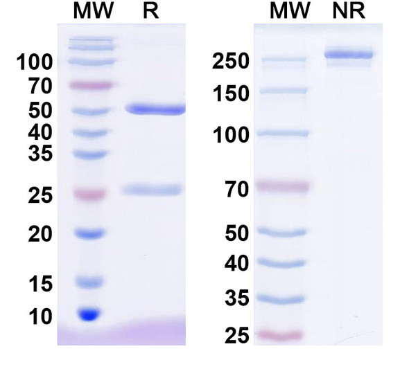 Anti-TRAAK K+ channel Recombinant Monoclonal Antibody (N445/98) - SDS-PAGE