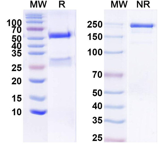 Anti-ADAM22 Recombinant Monoclonal Antibody (N46/30) - SDS-PAGE