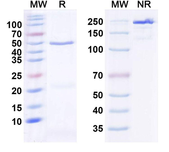 Anti-SALM2/LRFN1 Recombinant Monoclonal Antibody (N52B/13) - SDS-PAGE