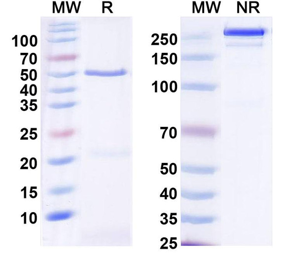 Anti-DNAH1 Recombinant Monoclonal Antibody (N251/14) - SDS-PAGE