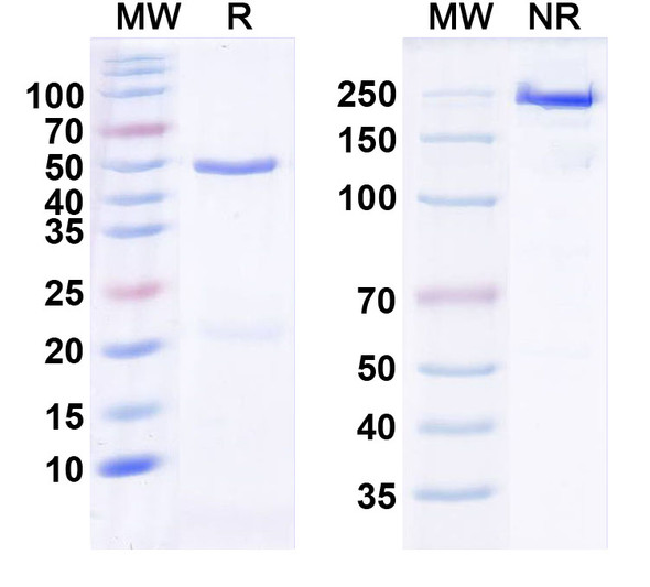 Anti-VGlut1 Recombinant Monoclonal Antibody (N28/7) - SDS-PAGE