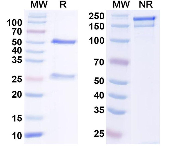 Anti-GABA(B)R1 Recombinant Monoclonal Antibody (N93A/51) - SDS-PAGE