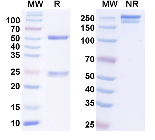 Anti-MiRP4 K+ channel Recombinant Monoclonal Antibody (N472/88) - SDS-PAGE