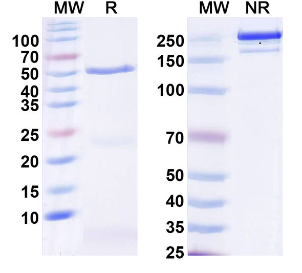 Anti-Neurabin-1/Ppp1r9a Recombinant Monoclonal Antibody (L129/88) - SDS-PAGE