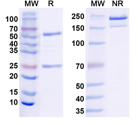 Anti-Bassoon Recombinant Monoclonal Antibody (L124/59) - SDS-PAGE