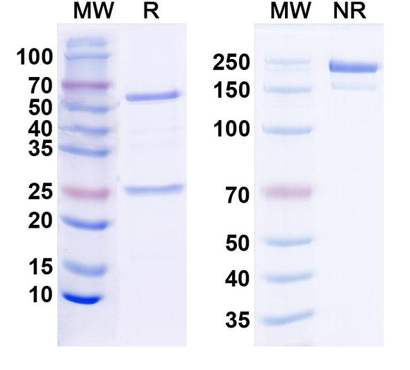 Anti-TRAK1 Recombinant Monoclonal Antibody (N389/35) - SDS-PAGE