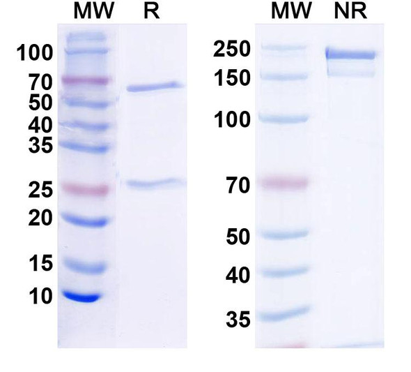Anti-Shank2 Recombinant Monoclonal Antibody (N23B/6) - SDS-PAGE
