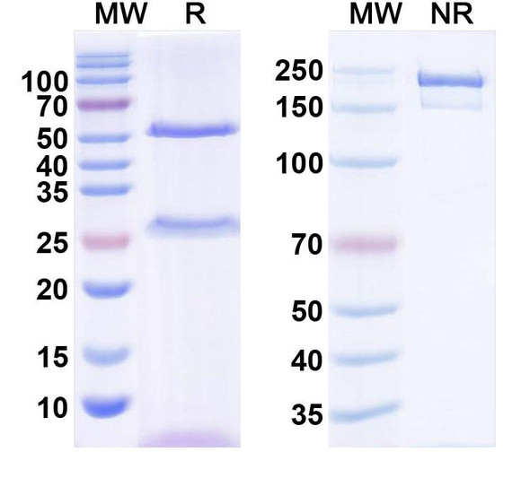 Anti-Shank2 Recombinant Monoclonal Antibody (N23B/69) - SDS-PAGE