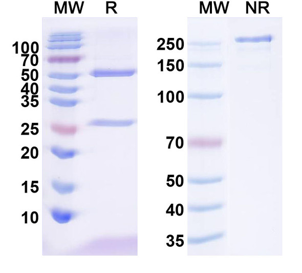 Anti-IRSp53/BAIAP2 Recombinant Monoclonal Antibody (L117/1) - SDS-PAGE