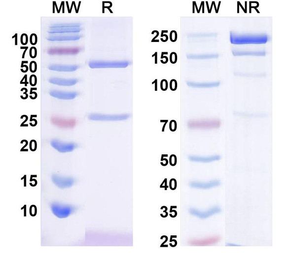 Anti-Nav1.6 Na+ channel Recombinant Monoclonal Antibody (K82/36) - SDS-PAGE