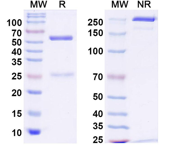 Anti-TWIK-2 K+ channel Recombinant Monoclonal Antibody (N469/28) - SDS-PAGE