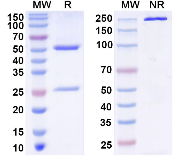 Anti-GIT1 Recombinant Monoclonal Antibody (N39B/24) - SDS-PAGE