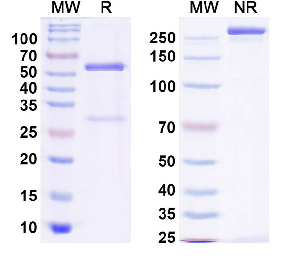 Anti-GIT1 Recombinant Monoclonal Antibody (N39B/8) - SDS-PAGE
