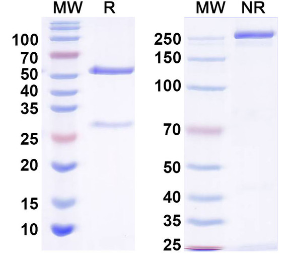 Anti-MMACHC Recombinant Monoclonal Antibody (N230/21R) - SDS-PAGE
